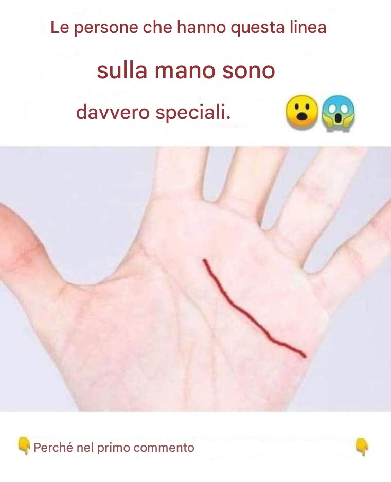 Le persone che hanno questa linea sulla mano sono davvero speciali.