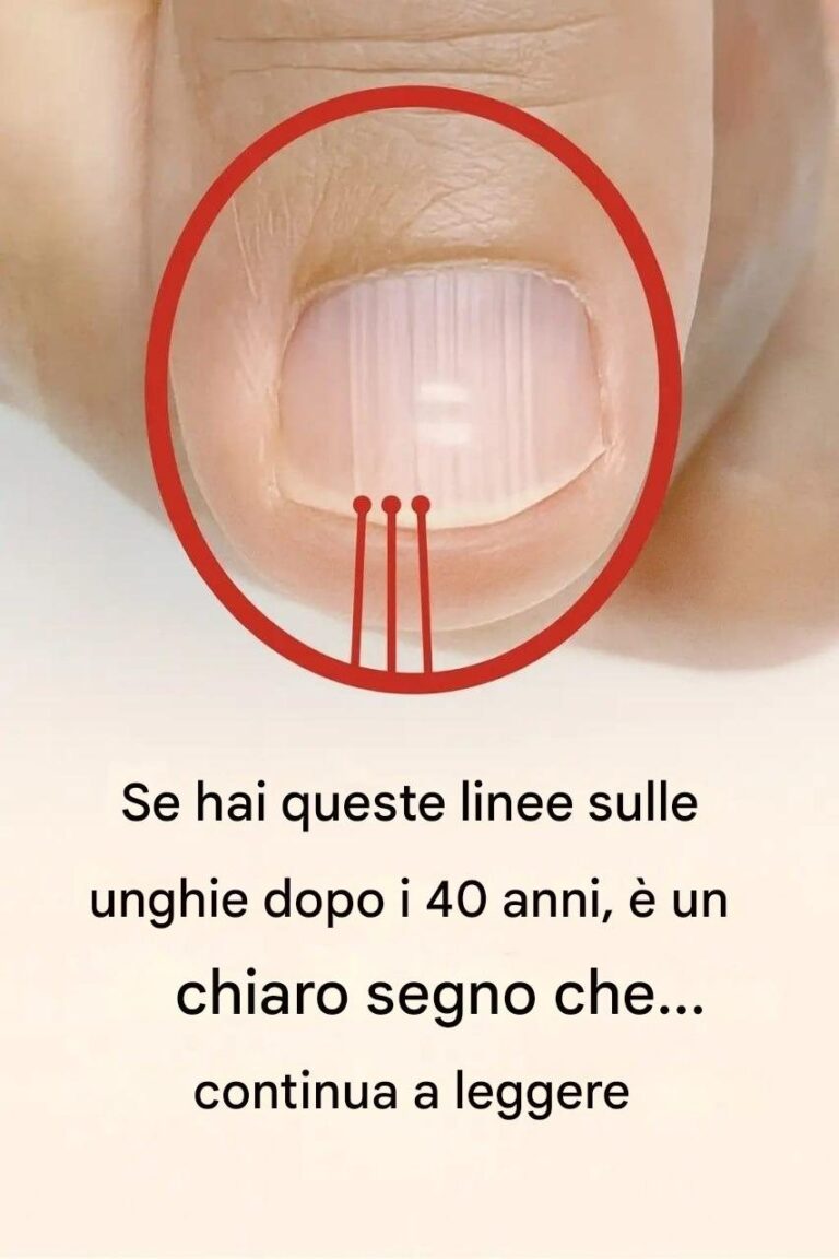 Le Tue Unghie Dopo i 40 Anni: Cosa Rivelano Sulla Tua Salute