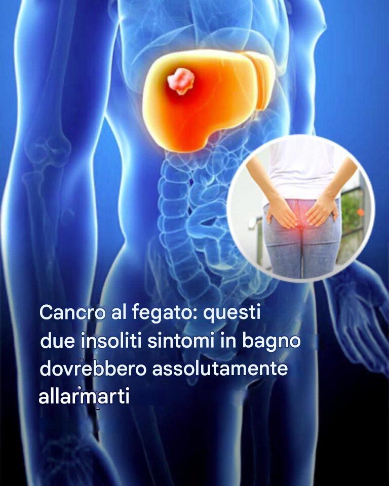 Cancro al fegato: sintomi della malattia che ha causato la morte di Thierry Ardisson