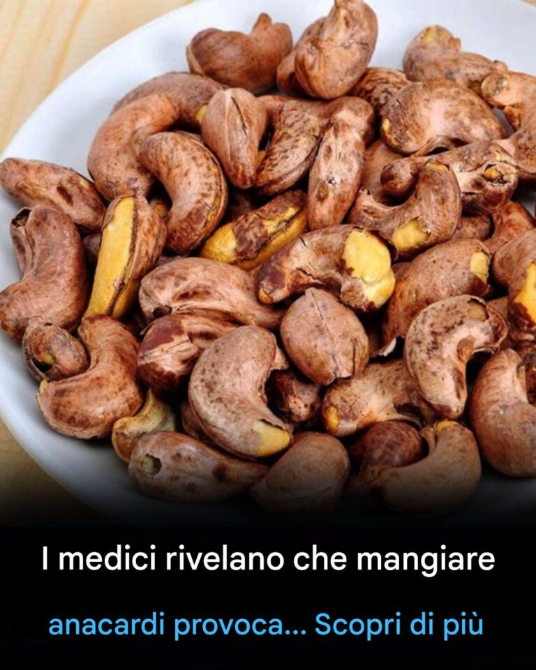 I medici rivelano che mangiare anacardi provoca